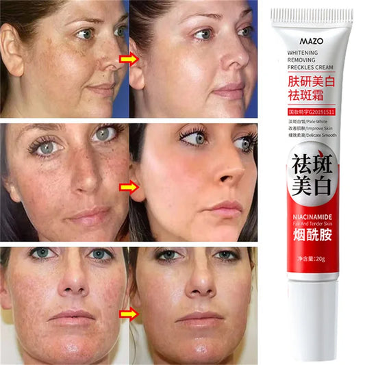 Powerful Spot-Removing Whiten Cream Brighten Skin Fast Eliminates Melanin Pigmentation Melasma Dark Spots Korean Skin Care