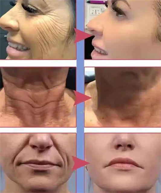 Retinol Anti-wrinkle Cream Collagen Anti-Aging Instant Removal Face Neck Wrinkle Efficient Moisturizing Firming Korean Skin Care