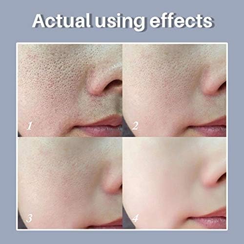 LANBENA - Pore Solution Serum (Original)