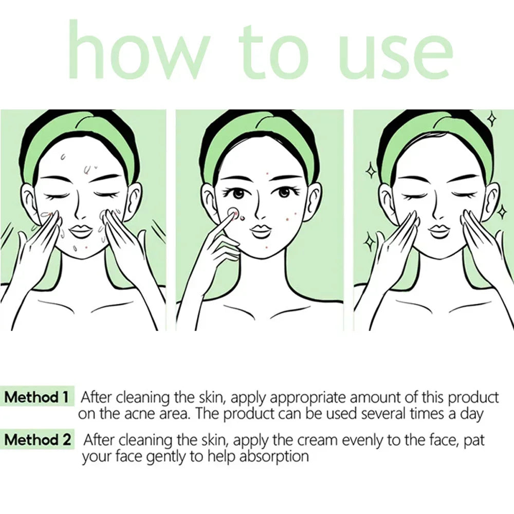 Pore Shrinking Cream Acne Pit Repair Products for Men and Women Remove acne mark scars Large pore anti-inflammatory smooth skin