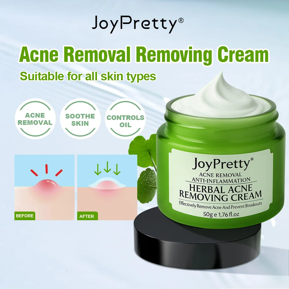 JoyPretty Herbal Acne Treatment Face Cream Elimination Large Pores Oil Control Shrink Pore Facial Cream Skin Care Beauty Health