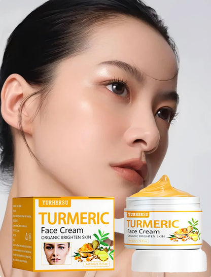 Anti Acne Turmeric Cream, Fades Scars & Dark Spots, for Oily and Dull Skin, Brightening Turmeric Face Care Treatment, 50ml