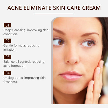 Pimple Acne Treatment Face Cream Oil Control Nourish Balance Refreshing Repairing Pimple Remover Acne Removing Cleansing Cream