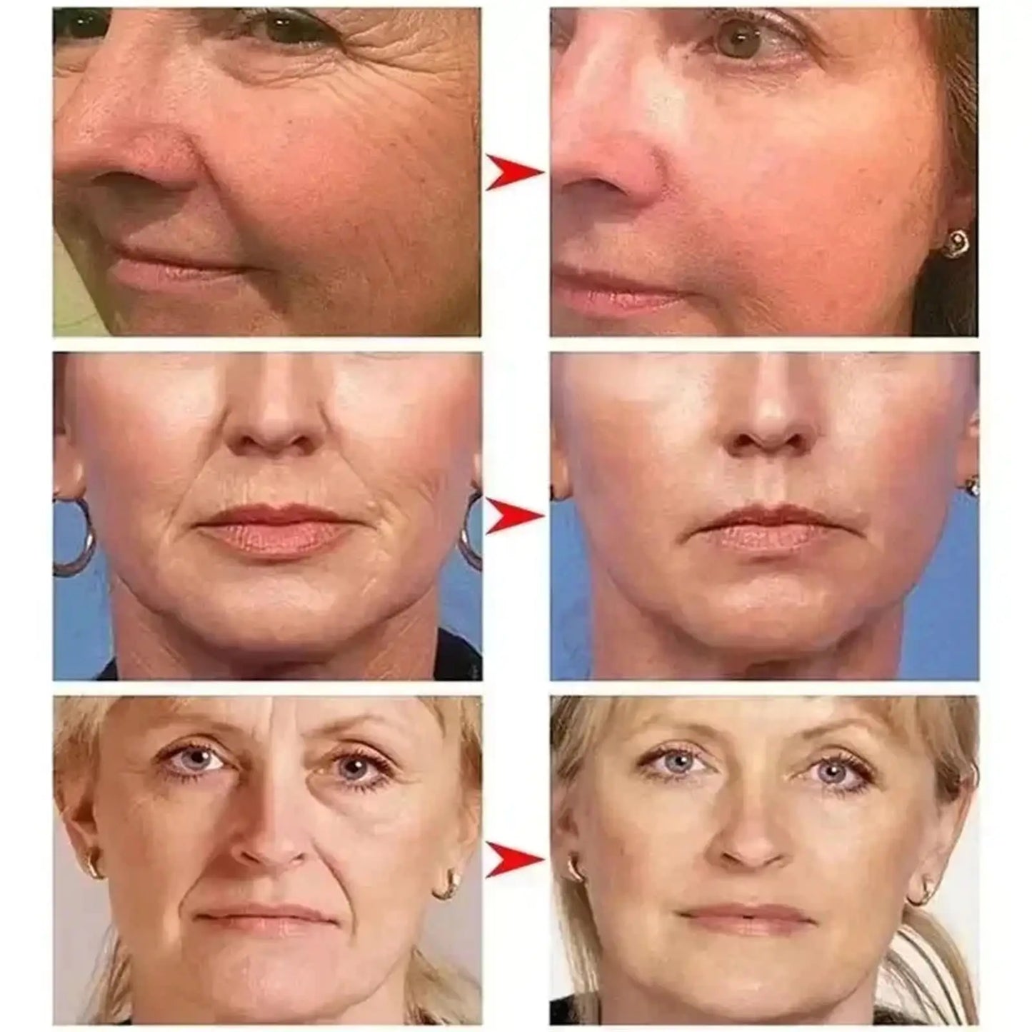 Retinol Anti-wrinkle Cream Collagen Anti-Aging Instant Removal Face Neck Wrinkle Efficient Moisturizing Firming Korean Skin Care