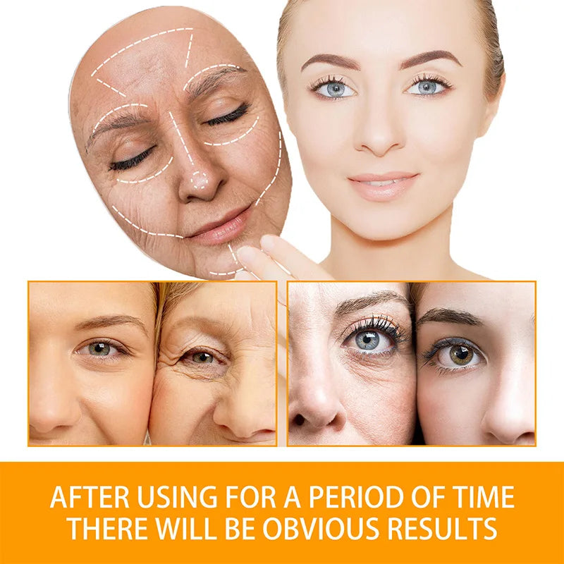 Anti Acne Turmeric Cream, Fades Scars & Dark Spots, for Oily and Dull Skin, Brightening Turmeric Face Care Treatment, 50ml