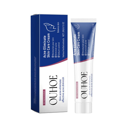 Pimple Acne Treatment Face Cream Oil Control Nourish Balance Refreshing Repairing Pimple Remover Acne Removing Cleansing Cream