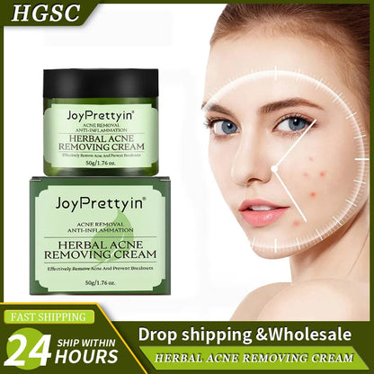 Herbal Acne Moving Cream Long Lasting Moisturizing Face Care Products Oil Control Fading Acne Scars Marks Skin Care Beauty