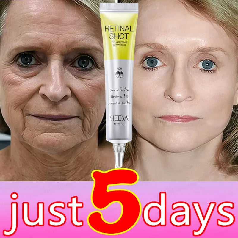 Retinol Anti-wrinkle Cream Collagen Anti-Aging Instant Removal Face Neck Wrinkle Efficient Moisturizing Firming Korean Skin Care