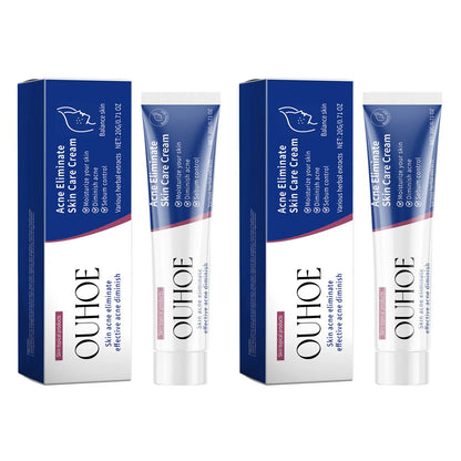 Pimple Acne Treatment Face Cream Oil Control Nourish Balance Refreshing Repairing Pimple Remover Acne Removing Cleansing Cream