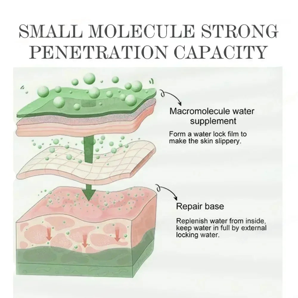 Anti-Acne Cream Effectively Removes Skin Nodules Pustules Cysts Papules Blackheads Men And Women Acne Skin Care Essence Cream