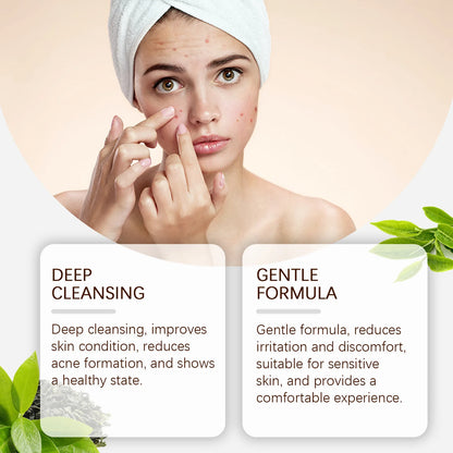 Pimple Acne Treatment Face Cream Oil Control Nourish Balance Refreshing Repairing Pimple Remover Acne Removing Cleansing Cream