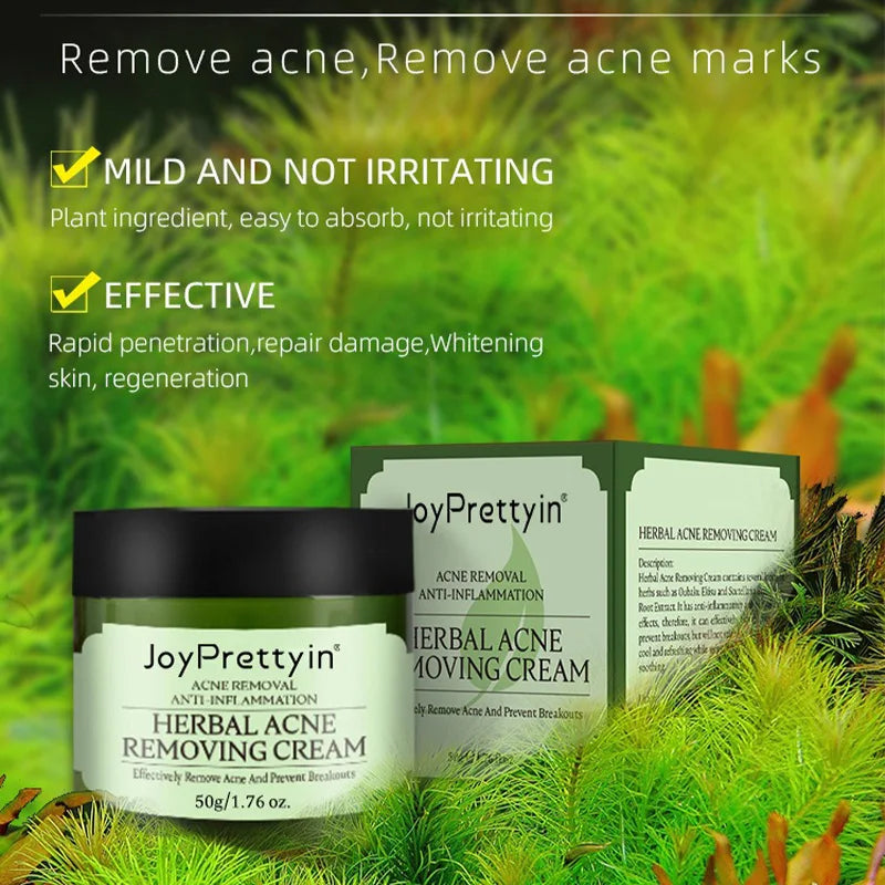 Herbal Acne Moving Cream Long Lasting Moisturizing Face Care Products Oil Control Fading Acne Scars Marks Skin Care Beauty