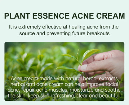 JoyPretty Herbal Acne Treatment Face Cream Elimination Large Pores Oil Control Shrink Pore Facial Cream Skin Care Beauty Health