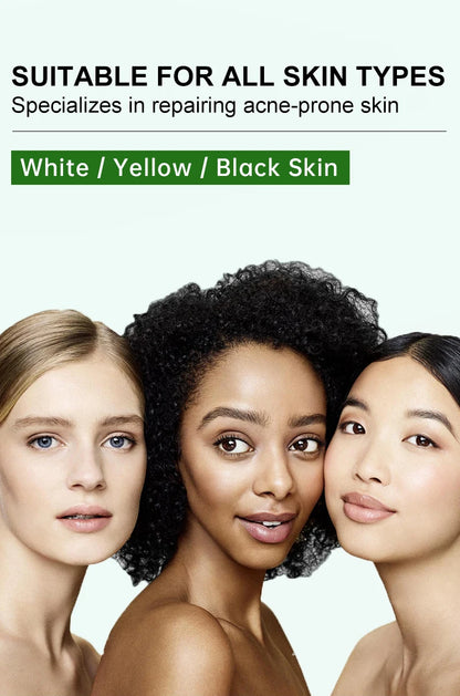 JoyPretty Herbal Acne Treatment Face Cream Elimination Large Pores Oil Control Shrink Pore Facial Cream Skin Care Beauty Health