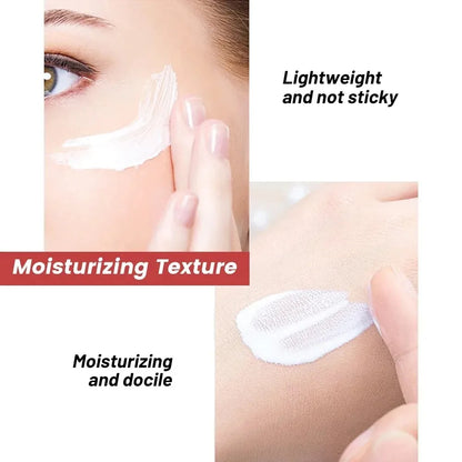 1/3/5pcs Whitening Freckle Cream Niacinamide Remove Dark Spot Cream Anti Freckle and Aging Cream Fade Pigmentation Melasma Skin