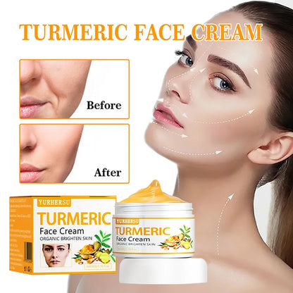Anti Acne Turmeric Cream, Fades Scars & Dark Spots, for Oily and Dull Skin, Brightening Turmeric Face Care Treatment, 50ml