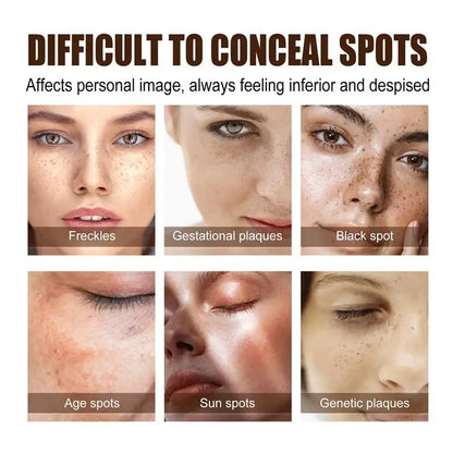 Powerful Spot-Removing Whiten Cream Brighten Skin Fast Eliminates Melanin Pigmentation Melasma Dark Spots Korean Skin Care