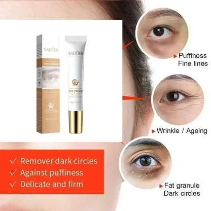 Snail Eye Cream Anti Dark Circles Under The Eyes Remove Eye bags Moisturizing Anti-Aging Eyes Skin Care Products