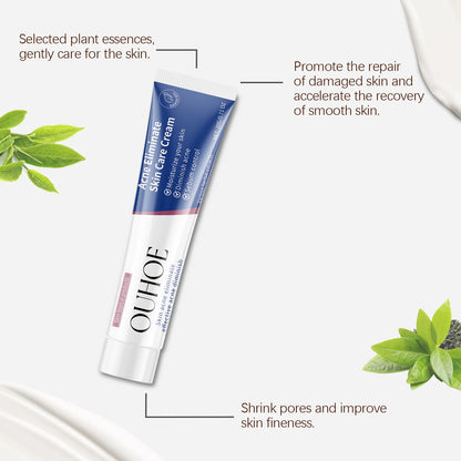 Pimple Acne Treatment Face Cream Oil Control Nourish Balance Refreshing Repairing Pimple Remover Acne Removing Cleansing Cream