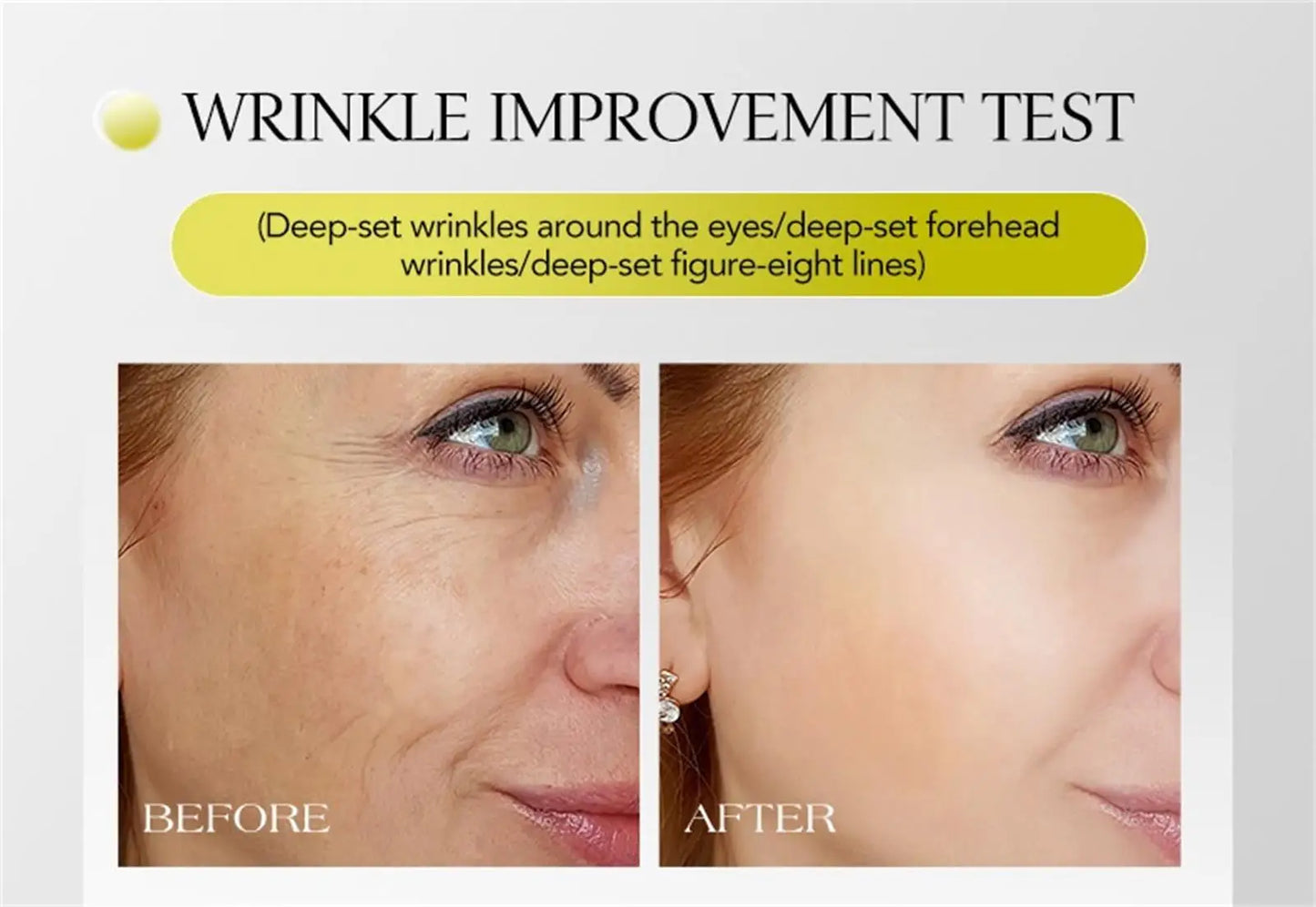 Retinol Anti-wrinkle Cream Collagen Anti-Aging Instant Removal Face Neck Wrinkle Efficient Moisturizing Firming Korean Skin Care