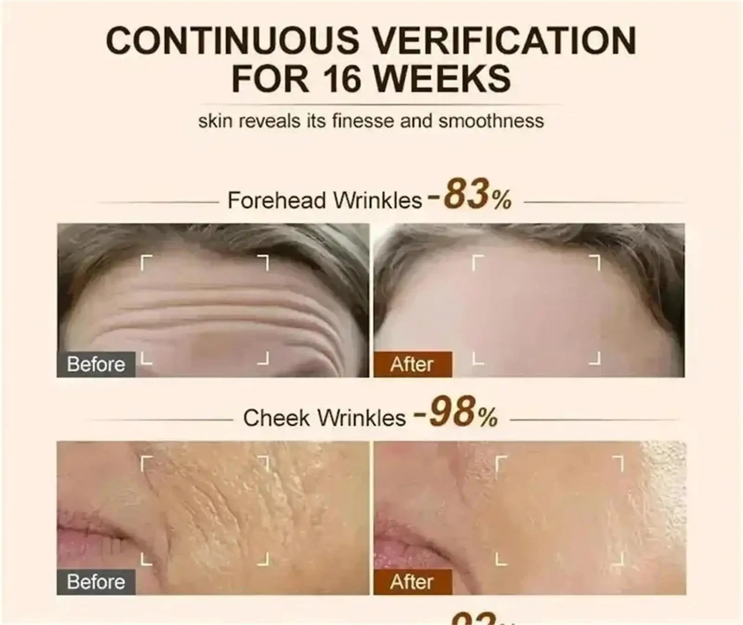 Retinol Anti-wrinkle Cream Collagen Anti-Aging Instant Removal Face Neck Wrinkle Efficient Moisturizing Firming Korean Skin Care