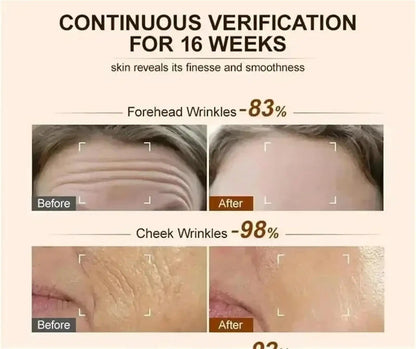 Retinol Anti-wrinkle Cream Collagen Anti-Aging Instant Removal Face Neck Wrinkle Efficient Moisturizing Firming Korean Skin Care