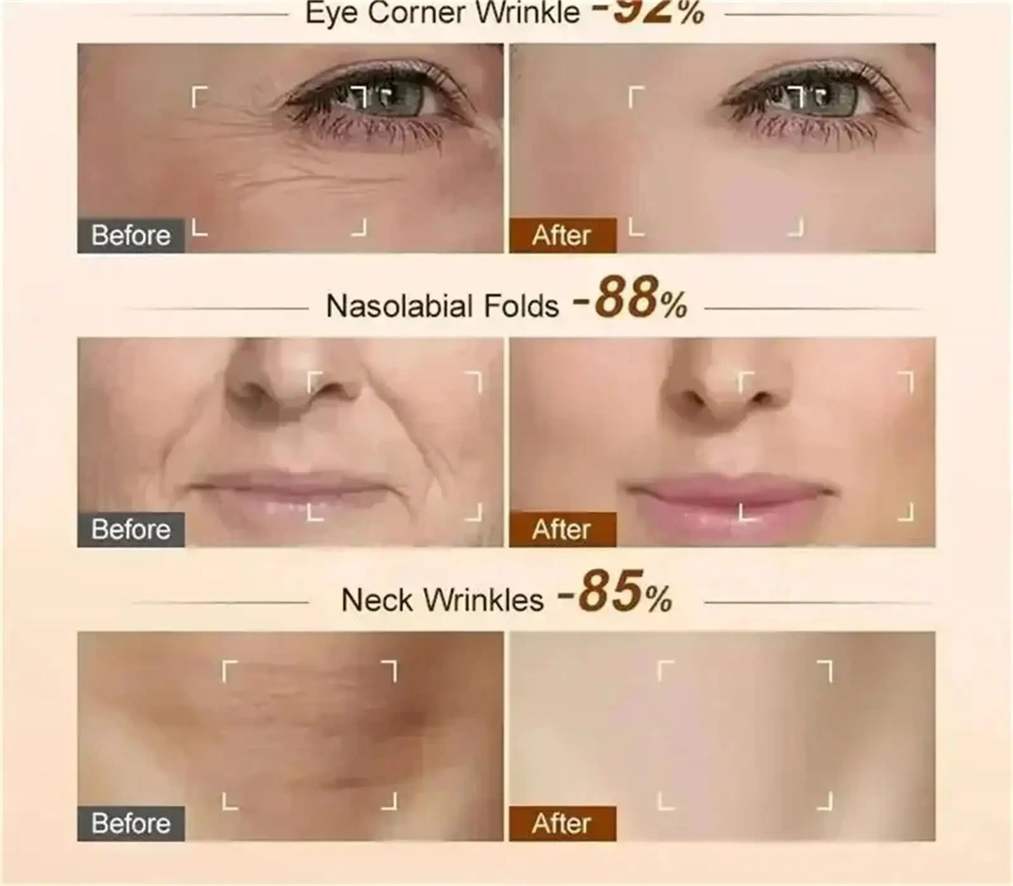 Retinol Anti-wrinkle Cream Collagen Anti-Aging Instant Removal Face Neck Wrinkle Efficient Moisturizing Firming Korean Skin Care