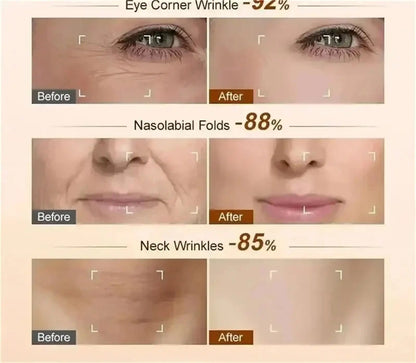 Retinol Anti-wrinkle Cream Collagen Anti-Aging Instant Removal Face Neck Wrinkle Efficient Moisturizing Firming Korean Skin Care