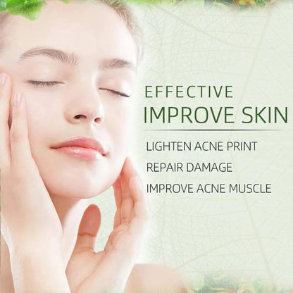 Herbal Acne Moving Cream Long Lasting Moisturizing Face Care Products Oil Control Fading Acne Scars Marks Skin Care Beauty