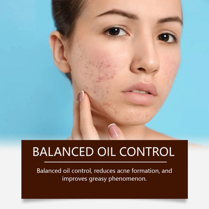 Pimple Acne Treatment Face Cream Oil Control Nourish Balance Refreshing Repairing Pimple Remover Acne Removing Cleansing Cream