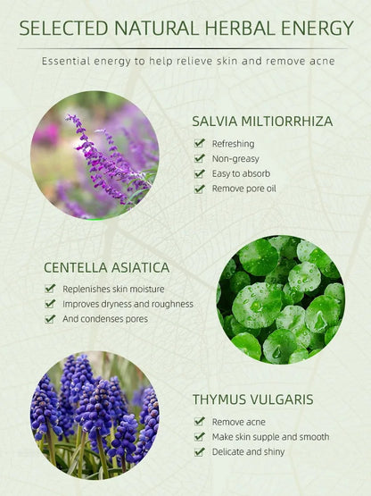 Herbal Acne Moving Cream Long Lasting Moisturizing Face Care Products Oil Control Fading Acne Scars Marks Skin Care Beauty