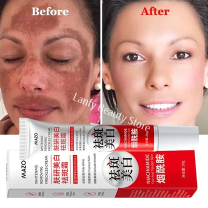 Powerful Spot-Removing Whiten Cream Brighten Skin Fast Eliminates Melanin Pigmentation Melasma Dark Spots Korean Skin Care