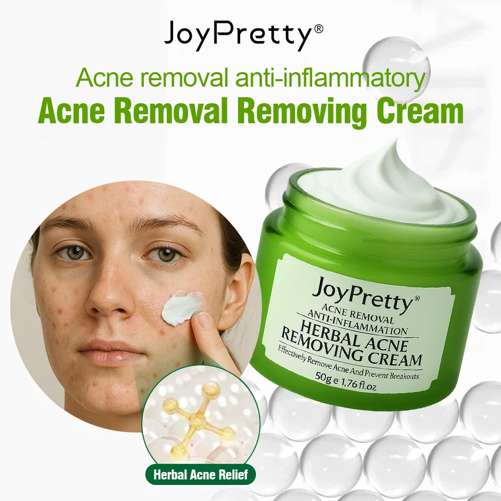 JoyPretty Herbal Acne Treatment Face Cream Elimination Large Pores Oil Control Shrink Pore Facial Cream Skin Care Beauty Health
