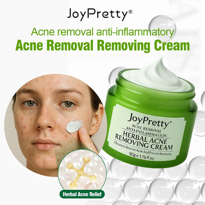JoyPretty Herbal Acne Treatment Face Cream Elimination Large Pores Oil Control Shrink Pore Facial Cream Skin Care Beauty Health