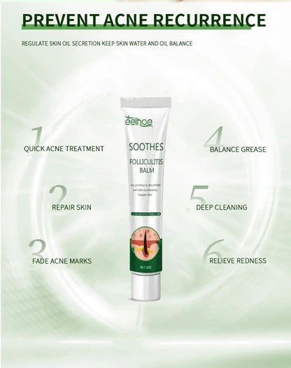 Anti-Acne Cream Effectively Removes Skin Nodules Pustules Cysts Papules Blackheads Men And Women Acne Skin Care Essence Cream