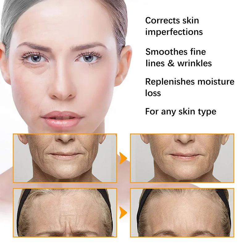 Anti Acne Turmeric Cream, Fades Scars & Dark Spots, for Oily and Dull Skin, Brightening Turmeric Face Care Treatment, 50ml