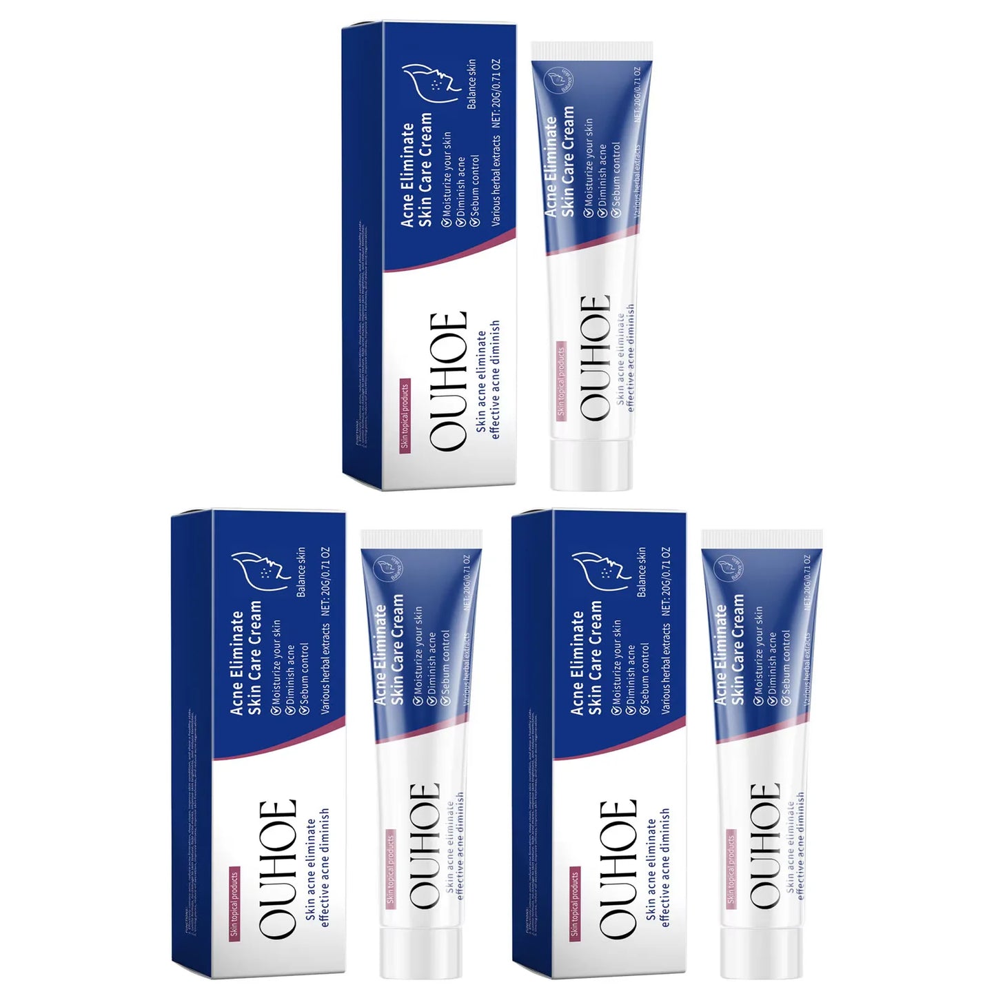 Pimple Acne Treatment Face Cream Oil Control Nourish Balance Refreshing Repairing Pimple Remover Acne Removing Cleansing Cream