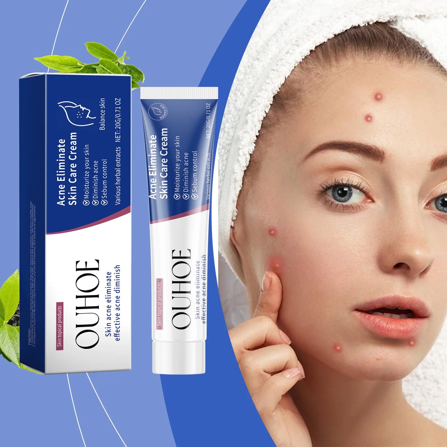 Pimple Acne Treatment Face Cream Oil Control Nourish Balance Refreshing Repairing Pimple Remover Acne Removing Cleansing Cream