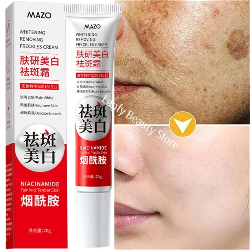 Powerful Spot-Removing Whiten Cream Brighten Skin Fast Eliminates Melanin Pigmentation Melasma Dark Spots Korean Skin Care
