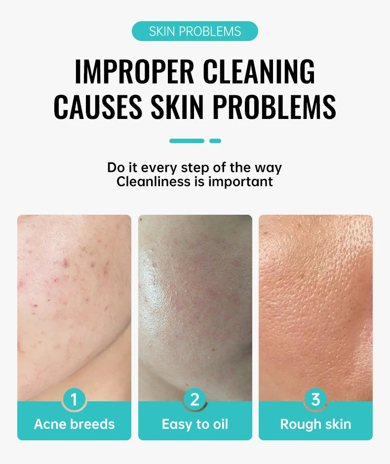 Salicylic Acid Acne Treatment Face Cream Repair Pimple Spots Deep Cleaning Pore Shrinking Anti-acne Scar Oil Control Moisturizer