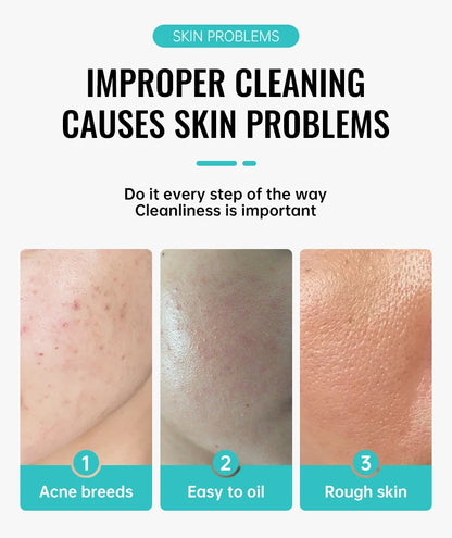 Salicylic Acid Acne Treatment Face Cream Repair Pimple Spots Deep Cleaning Pore Shrinking Anti-acne Scar Oil Control Moisturizer