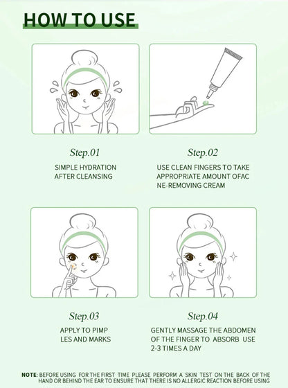 Anti-Acne Cream Effectively Removes Skin Nodules Pustules Cysts Papules Blackheads Men And Women Acne Skin Care Essence Cream