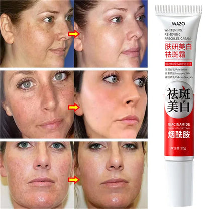 Powerful Spot-Removing Whiten Cream Brighten Skin Fast Eliminates Melanin Pigmentation Melasma Dark Spots Korean Skin Care