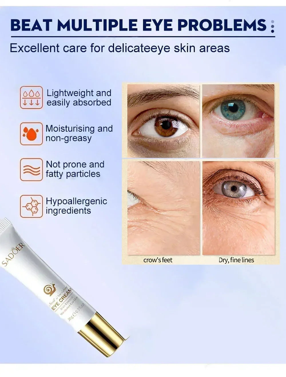 Snail Eye Cream Anti Dark Circles Under The Eyes Remove Eye bags Moisturizing Anti-Aging Eyes Skin Care Products