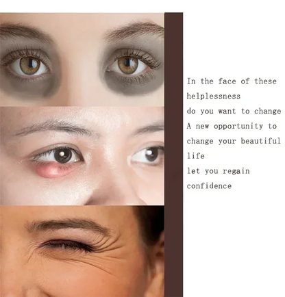 Snail Eye Cream Anti Dark Circles Under The Eyes Remove Eye bags Moisturizing Anti-Aging Eyes Skin Care Products