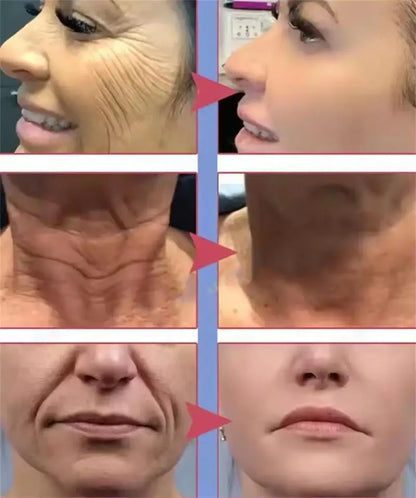 Retinol Anti-wrinkle Cream Collagen Anti-Aging Instant Removal Face Neck Wrinkle Efficient Moisturizing Firming Korean Skin Care