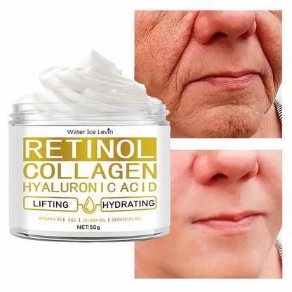 Retinol Anti Aging Face Cream Moisturizing Wrinkle Remover Firming Lifting Collagen Hyaluronic Acid Cream Nourishing Skin Care