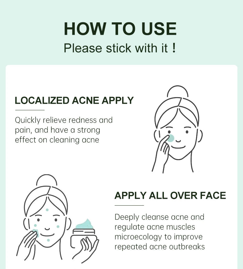 JoyPretty Herbal Acne Treatment Face Cream Elimination Large Pores Oil Control Shrink Pore Facial Cream Skin Care Beauty Health