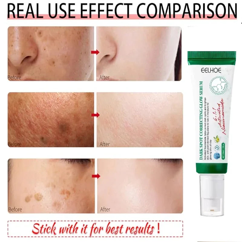 Dark Spot Corrector Cream Reduces Dark Spots Brightening Care Hydrates and Nourishes skin Reduces Melanin Fades Spots  Freckles