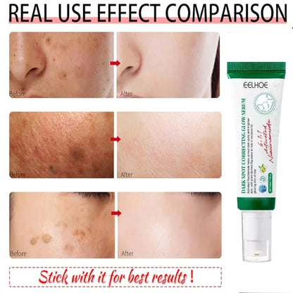 Dark Spot Corrector Cream Reduces Dark Spots Brightening Care Hydrates and Nourishes skin Reduces Melanin Fades Spots  Freckles